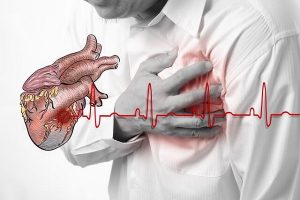Bệnh suy tim là gì?